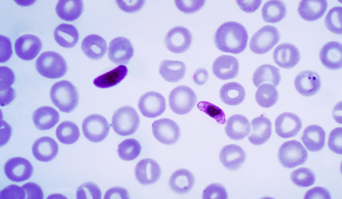 Plasmodium falciparum 1 - 4 bekannte Arten von Malaria, auf die Sie achten müssen