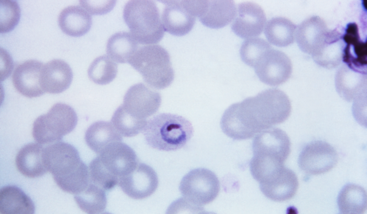 Plasmodium ovale - 4 bekannte Arten von Malaria, auf die Sie achten müssen
