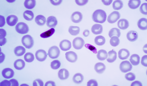 Plasmodium falciparum 1 300x175 - Plasmodium_falciparum (1)