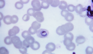 Plasmodium ovale 300x175 - Plasmodium_ovale