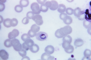 Plasmodium ovale 01 300x197 - Plasmodium_ovale_01