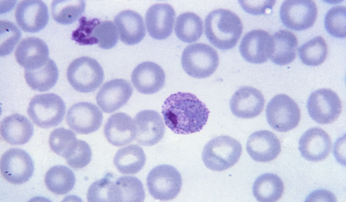 Plasmodium vivax - 4 bekannte Arten von Malaria, auf die Sie achten müssen