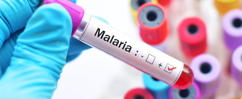Malaria