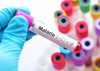 Malaria