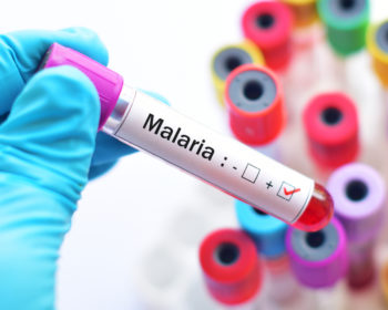 Malaria