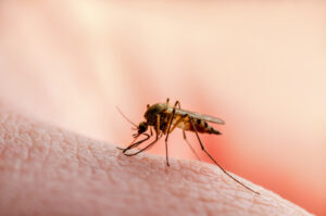 shutterstock 1483138139 1 300x199 - Dangerous,Malaria,Infected,Mosquito,Skin,Bite.,Leishmaniasis,,Encephalitis,,Yellow,Fever,