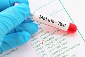 shutterstock 736218490 300x200 - Blood,Sample,With,Requisition,Form,For,Malaria,Test