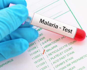 shutterstock 736218490 350x280 - Malaria-Behandlung: Medikamente, Behandlungsdauer