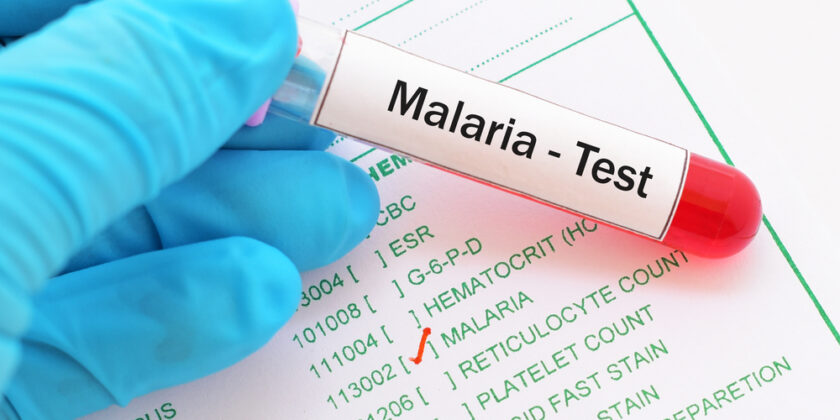 shutterstock 736218490 840x420 - Malaria-Behandlung: Medikamente, Behandlungsdauer