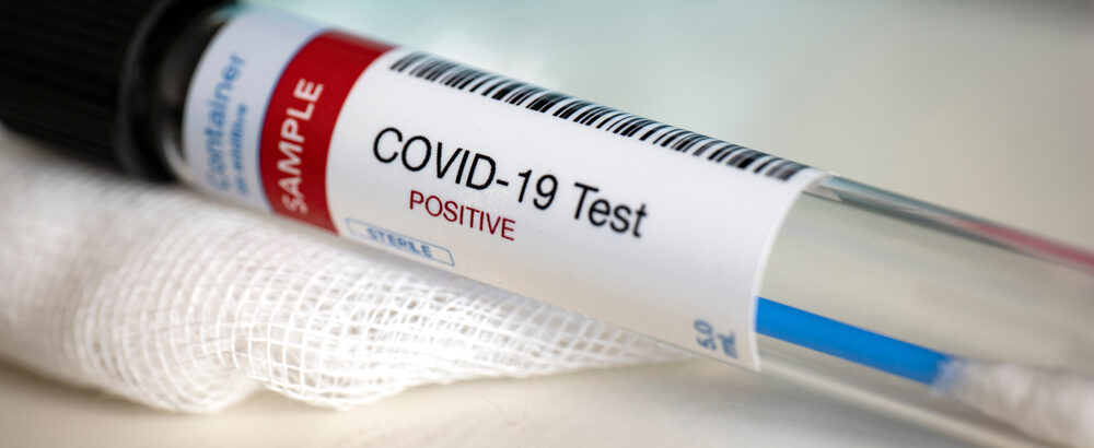 shutterstock 1673330692 1000x410 - COVID vs. Grippe vs. RSV – Die wichtigsten Unterschiede 2025