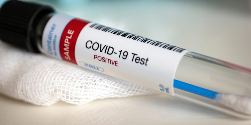 shutterstock 1673330692 840x420 - COVID vs. Grippe vs. RSV – Die wichtigsten Unterschiede 2025