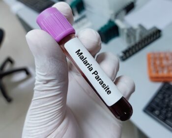 shutterstock 2056212401 350x280 - Die Zukunft der Malariaforschung