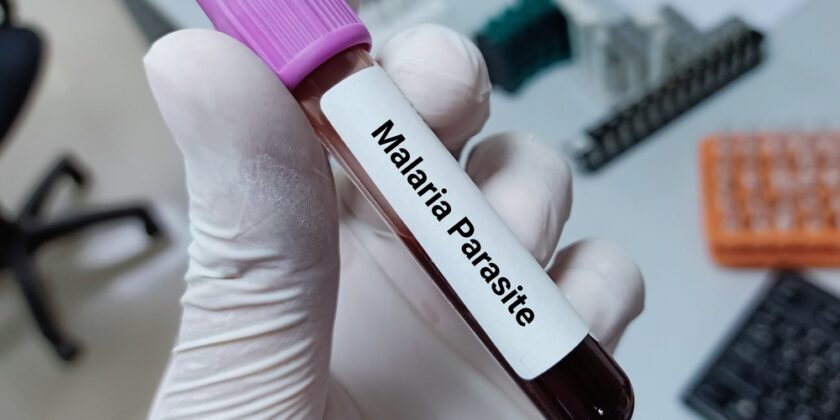 shutterstock 2056212401 840x420 - Die Zukunft der Malariaforschung
